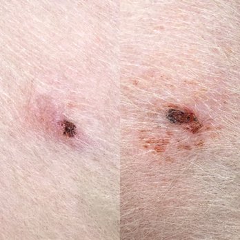 The Dog Wash Waggin - Close-up: Both shaved-off nipples two days later. - Pet Groomers Near Me - Hammond, Oregon