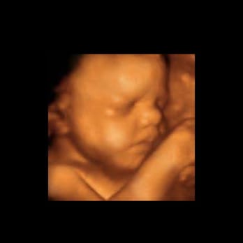 UC Baby Sydney - 3D&4D ultrasound clinic - Diagnostic Imaging Near Me - Sydney, Nova Scotia