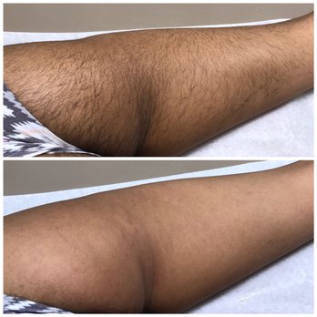 Venus Waxing Spa - Amazing results with waxing hair removal! - Laser Hair Removal Near Me - Miami, Florida