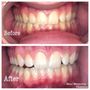 Photo of Maui Teeth Whitening And Tanning