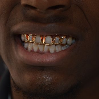 Baltimore Gold Fronts - Jewelry Near Me - Baltimore, Maryland Baltimore Gold Fronts - Jewelry Near Me - Baltimore, Maryland