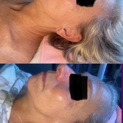 Skinsational - What a difference a facial makes