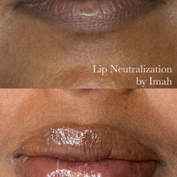 Lip Neutralization
