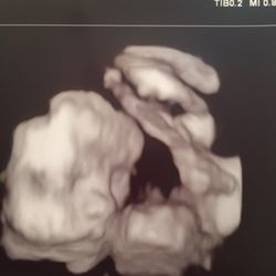 Maternal Fetal Associates - Latest sonogram pic