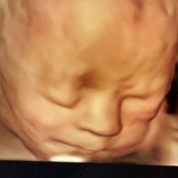 I Saw You First Imaging - See your baby in 3D/4D/5D Ultrasound .
Your Adventure starts with I Saw You First Imaging
701 E Main Street, Moorestown NJ 08057.