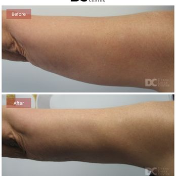 Derma Laser Centers - Medical Spas Near Me - Mercerville, New Jersey Derma Laser Centers - Medical Spas Near Me - Mercerville, New Jersey