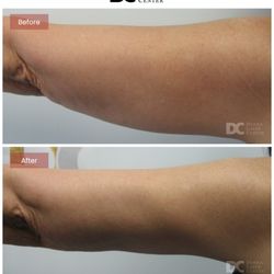 Derma Laser Centers