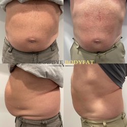 Goodbye Bodyfat