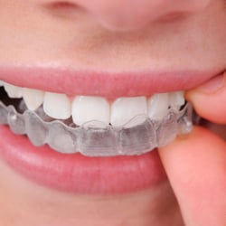 Gustav Kozina, DDS - Den Care Smile Center - Invisible Braces Round Lake Beach IL
