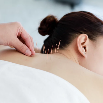 Earthy Ruby - Acupuncture Near Me - Cupertino, California Earthy Ruby - Acupuncture Near Me - Cupertino, California