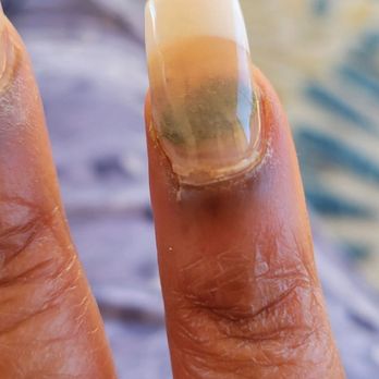 Lana’s Nails & Spa - That is some serious fungus - Nail Salons Near Me - Las Vegas, Nevada Lana’s Nails & Spa - That is some serious fungus - Nail Salons Near Me - Las Vegas, Nevada