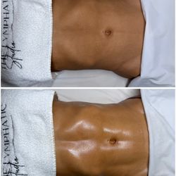 The Lymphatic Studio