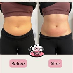 Body Sculpting Session one hour after