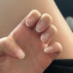 Luxe Nail and Spa - This is a photo I took after my terrible experience at Luxe Nails.