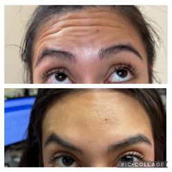 FoxyLook Aesthetics