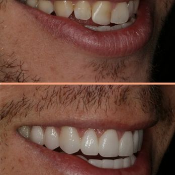 Dr. Jorg-Peter Rabanus - Cosmetic Dentists Near Me - San Francisco, California