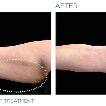 Evolution Body Works - Skin Care Near Me - Las Vegas, Nevada Evolution Body Works - Skin Care Near Me - Las Vegas, Nevada
