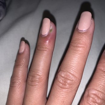 V's Nails Spa - My finger got infected from the manicure. - Nail Salons Near Me - Irvine, California