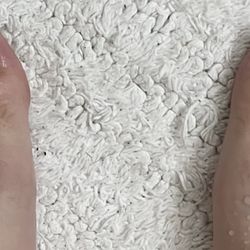 Friedman DPM A Podiatry , Rory J - THIS IS HOW MY ORIGINAL NAILS LOOKED LIKE BEFORE THE PROCEDURE!