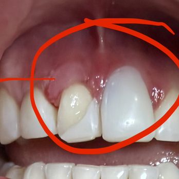 Sergio A Vega, DMD - General Dentistry Near Me - Miami Lakes, Florida
