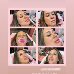 Couture Your Face - Lip blushing