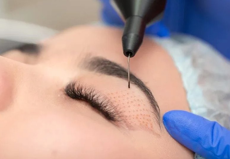 Westlake Skin Tightening Logo