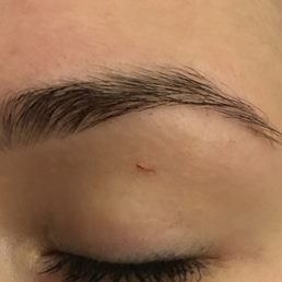 Cut underneath my eyebrow