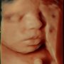 Photo of A Glimpse Before & After Ultrasound