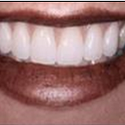 Modern Dental