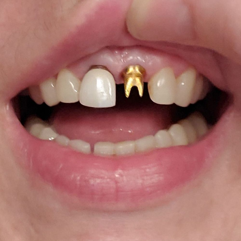 Ive been in pain for three years. Tonight this happend. I was fooled in to unnecessary work. No help no accountability. Ive been in pain for three years. Tonight this happend. I was fooled in to unnecessary work. No help no accountability.