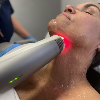 Universal Laser Center - Laser Hair Removal Near Me - Miami, Florida