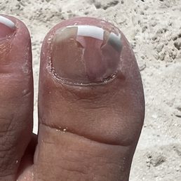 New Image Nails - How terrible does this look after THREE days?? - Nail Salons Near Me - Middletown, Delaware