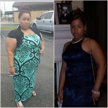 Ultimate Bariatrics - Main Office* - Starting weight to goal weight - Weight Loss Centers Near Me - Fort Worth, Texas Ultimate Bariatrics - Main Office* - Starting weight to goal weight - Weight Loss Centers Near Me - Fort Worth, Texas