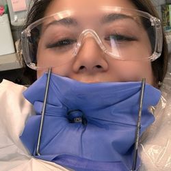 Jeannie A. Molato,DMD -Laser Dental Bakersfield - Say cheese... NO PAIN