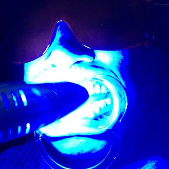 5280 Teeth Whitening - Teeth Whitening Near Me - Denver, Colorado