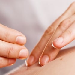 Los Gatos Health Well Center - Best Acupunture Dr. in Los Gatos
