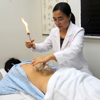 Serene Life Acupuncture - Dr. Li is performing cupping treatment - Acupuncture Near Me - Miami, Florida Serene Life Acupuncture - Dr. Li is performing cupping treatment - Acupuncture Near Me - Miami, Florida