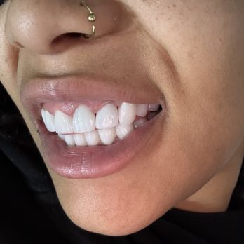 My Smile Center - General Dentistry Near Me - Miami, Florida My Smile Center - General Dentistry Near Me - Miami, Florida