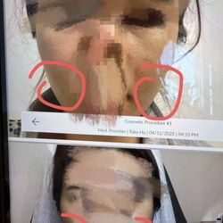 Wonder Medical Spa - The picture on the top shows the condition before treatment, while the one below shows the condition after treatment