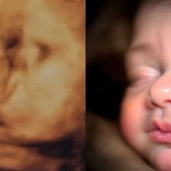 Chubby Cheeks 3D/4D Ultrasound Studio of High Point & Greensboro