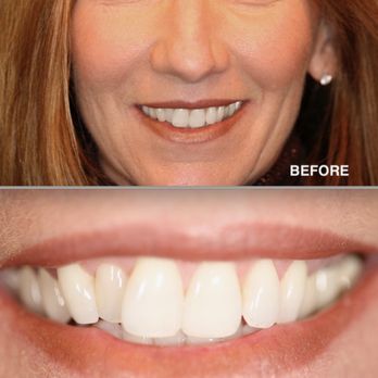 Aesthetic Dentistry Near Me