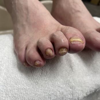 Bare Nails Studio - It's over a year for getting these down - Nail Technicians Near Me - Overland Park, Kansas