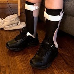 Progressive Orthotics