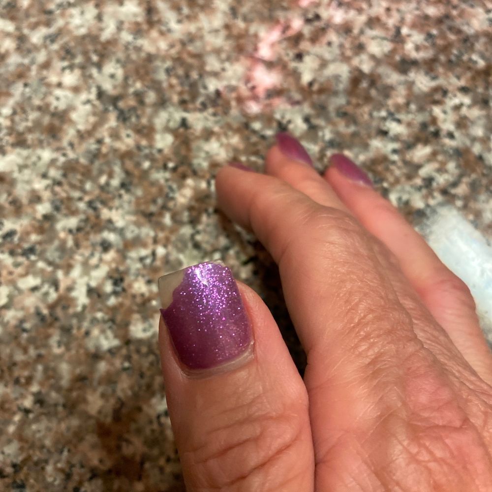 7 days later. Four of My nails have chipped like this. 7 days later. Four of My nails have chipped like this.