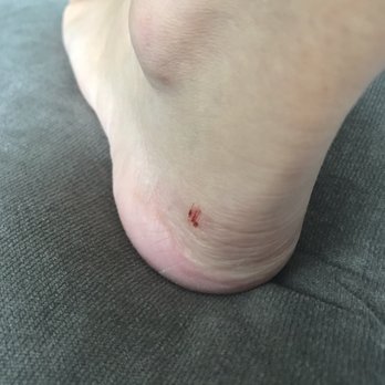 ME:U Nails & Spa - Scuffed me on my heel. Hurts and bled. How am I suppose to wear heels with a scuffed heel? - Nail Salons Near Me - Chicago, Illinois