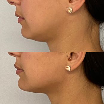 Clinique Derma MD - Aestheticians Near Me - Brossard, Quebec Clinique Derma MD - Aestheticians Near Me - Brossard, Quebec
