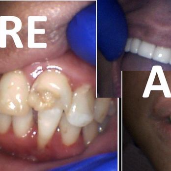 Waialae Dental Care - Done with Dr. Hoang - Cosmetic Dentists Near Me - Honolulu, Hawaii Waialae Dental Care - Done with Dr. Hoang - Cosmetic Dentists Near Me - Honolulu, Hawaii