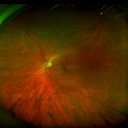 Closeup view of left eye. Closeup view of left eye.