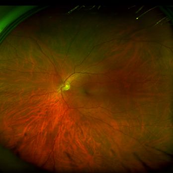 Almond Blossom Optometry - Closeup view of left eye. - Optometrists Near Me - Ripon, California Almond Blossom Optometry - Closeup view of left eye. - Optometrists Near Me - Ripon, California