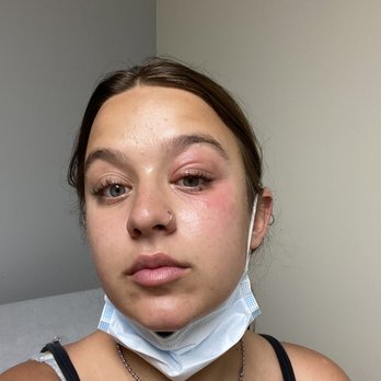 Amazing Lash Studio - Eye infection directly after receiving the lash lift and tint. - Eyelash Service Near Me - Owings Mills, Maryland Amazing Lash Studio - Eye infection directly after receiving the lash lift and tint. - Eyelash Service Near Me - Owings Mills, Maryland